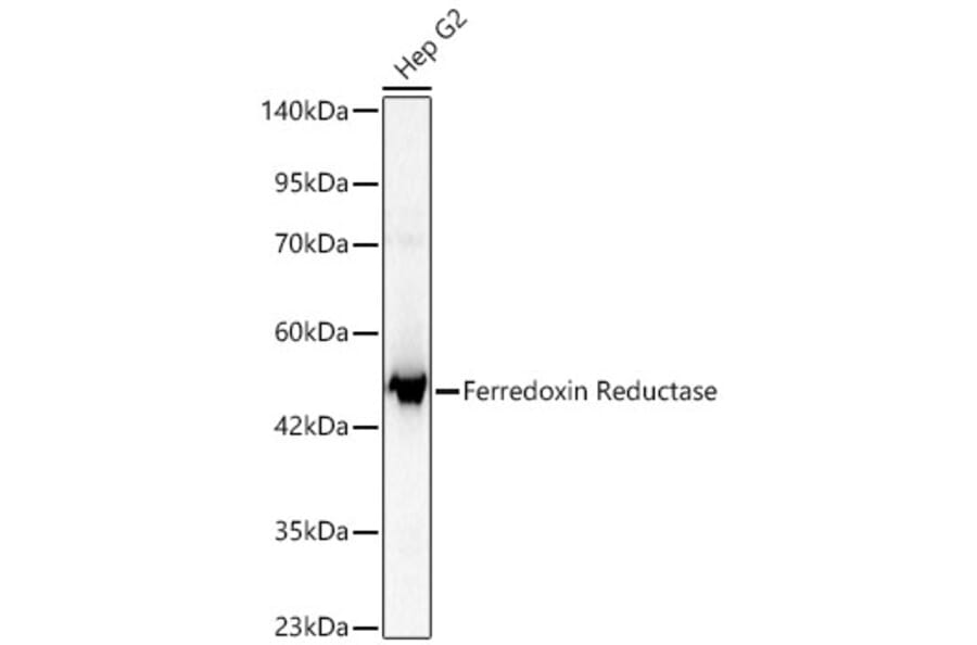Western Blot - Anti-Ferredoxin Reductase Antibody (A329368) - Antibodies.com