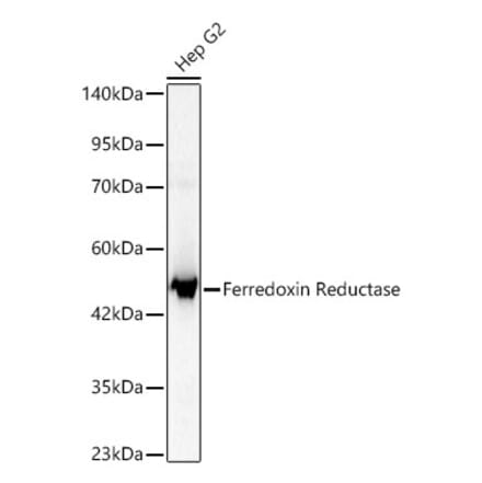 Western Blot - Anti-Ferredoxin Reductase Antibody (A329368) - Antibodies.com
