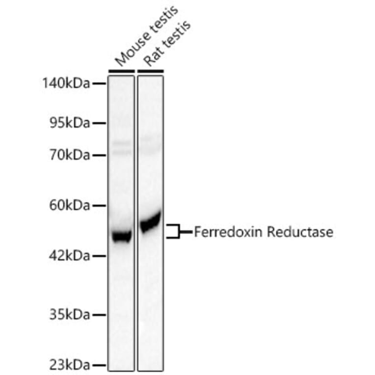 Western Blot - Anti-Ferredoxin Reductase Antibody (A329368) - Antibodies.com