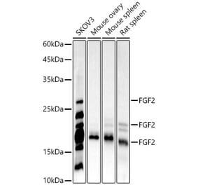 Western Blot - Anti-FGF2 Antibody [ARC51103] (A329369) - Antibodies.com