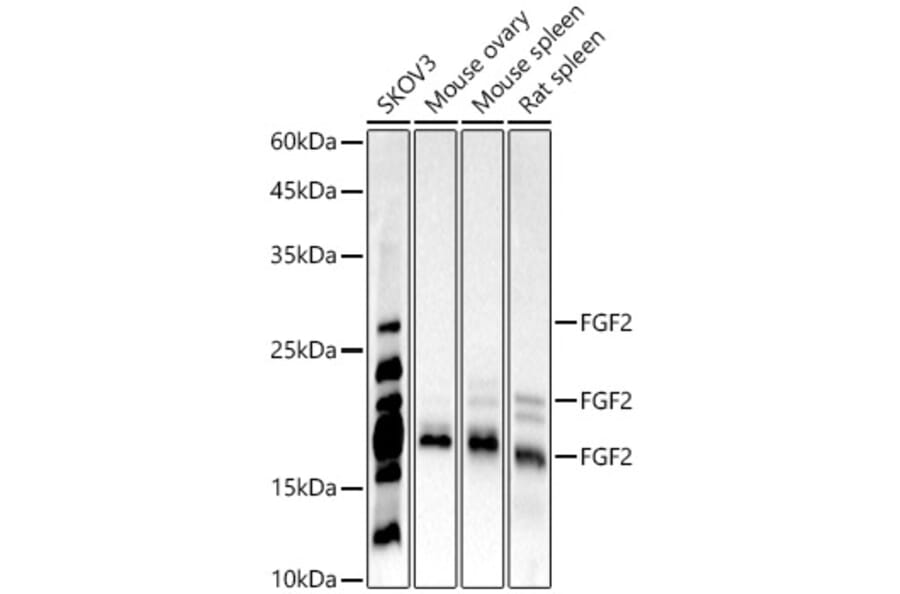 Western Blot - Anti-FGF2 Antibody [ARC51103] (A329369) - Antibodies.com