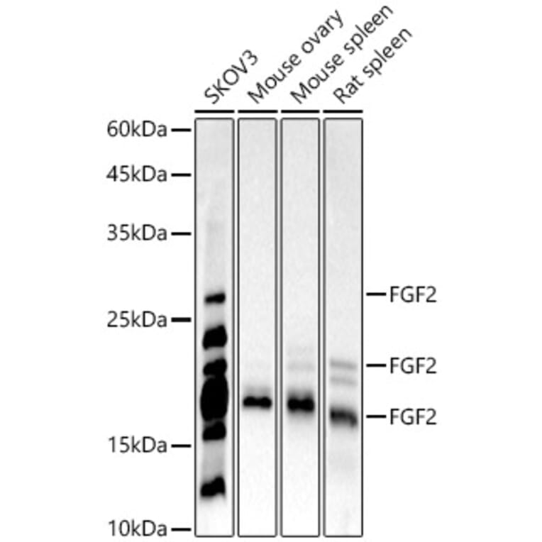 Western Blot - Anti-FGF2 Antibody [ARC51103] (A329369) - Antibodies.com
