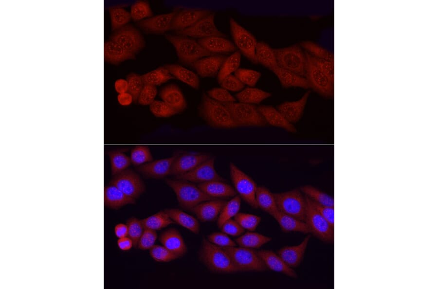 Immunofluorescence - Anti-FGF2 Antibody [ARC51103] (A329369) - Antibodies.com