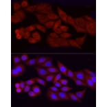 Immunofluorescence - Anti-FGF2 Antibody [ARC51103] (A329369) - Antibodies.com