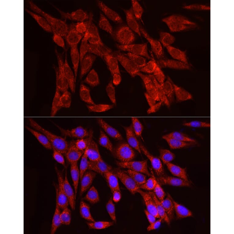 Immunofluorescence - Anti-FGF2 Antibody [ARC51103] (A329369) - Antibodies.com