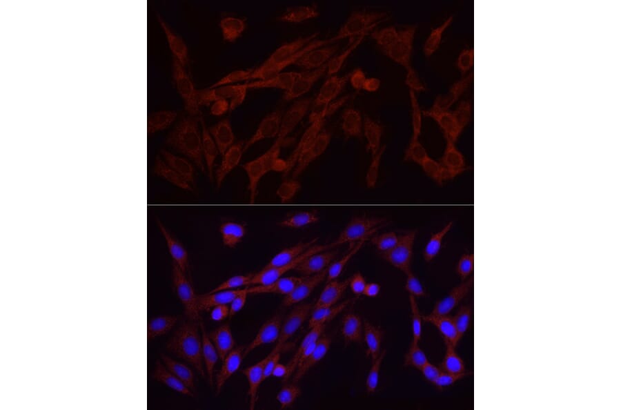 Immunofluorescence - Anti-FGF2 Antibody [ARC51103] (A329369) - Antibodies.com