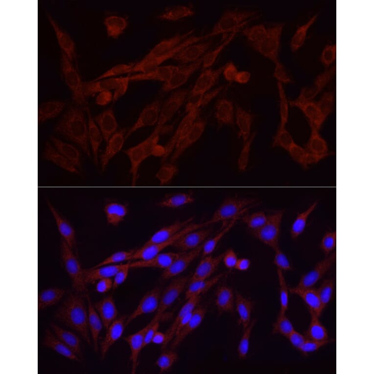 Immunofluorescence - Anti-FGF2 Antibody [ARC51103] (A329369) - Antibodies.com