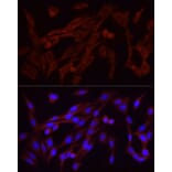 Immunofluorescence - Anti-FGF2 Antibody [ARC51103] (A329369) - Antibodies.com