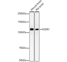 Western Blot - Anti-FGFR1 Antibody [ARC53422] (A329370) - Antibodies.com