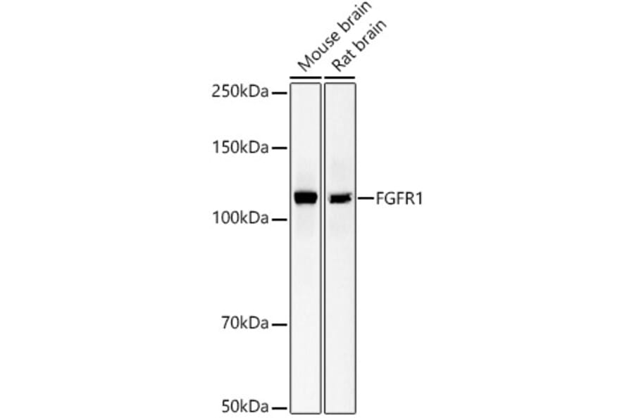 Western Blot - Anti-FGFR1 Antibody [ARC53422] (A329370) - Antibodies.com
