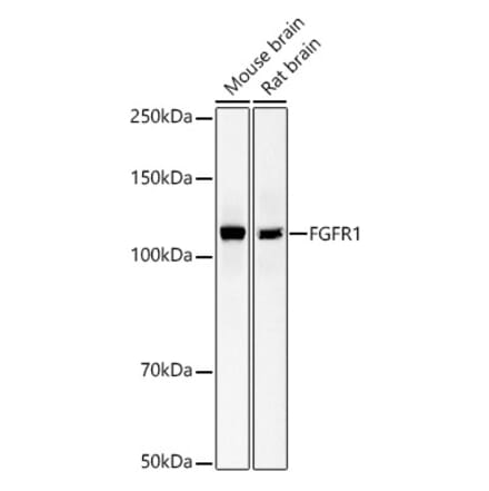 Western Blot - Anti-FGFR1 Antibody [ARC53422] (A329370) - Antibodies.com