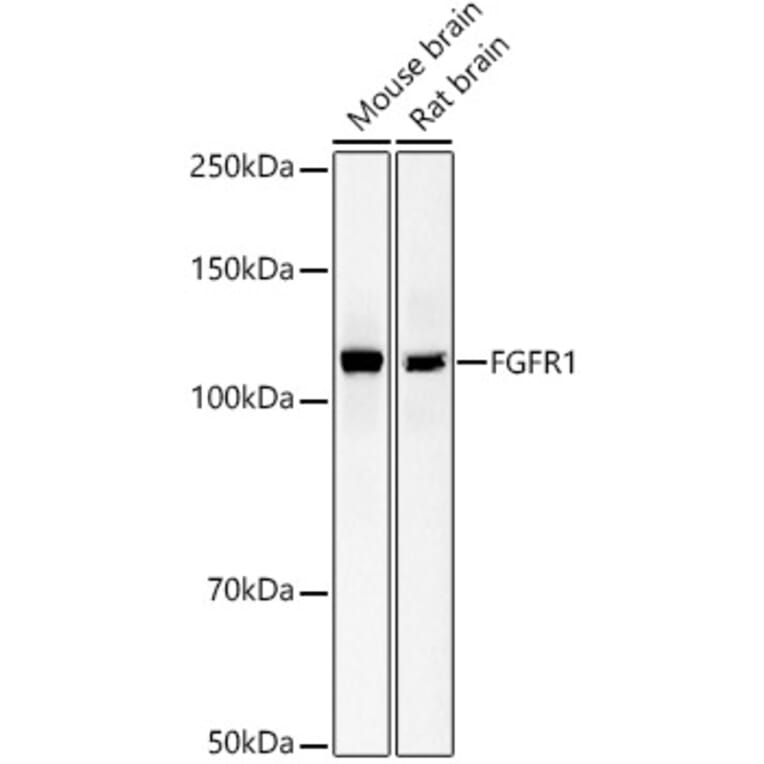 Western Blot - Anti-FGFR1 Antibody [ARC53422] (A329370) - Antibodies.com