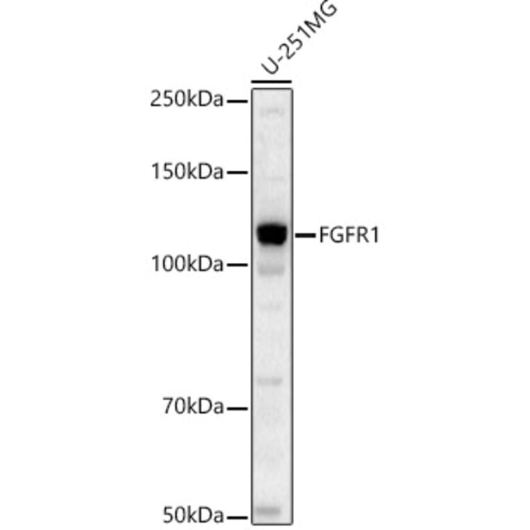 Western Blot - Anti-FGFR1 Antibody [ARC53422] (A329370) - Antibodies.com