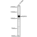 Western Blot - Anti-FGFR1 Antibody [ARC53422] (A329370) - Antibodies.com