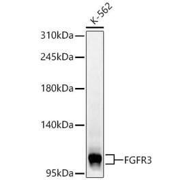 Western Blot - Anti-FGFR3 Antibody (A329371) - Antibodies.com