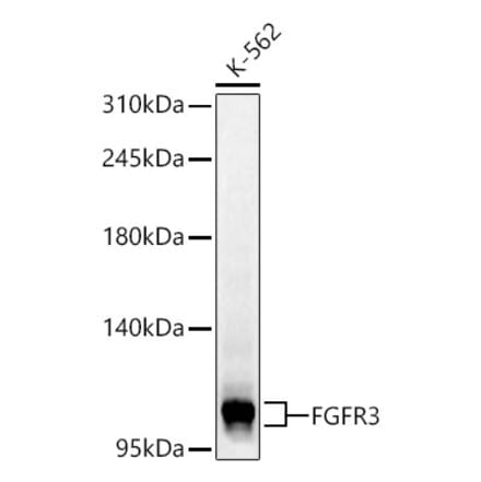 Western Blot - Anti-FGFR3 Antibody (A329371) - Antibodies.com