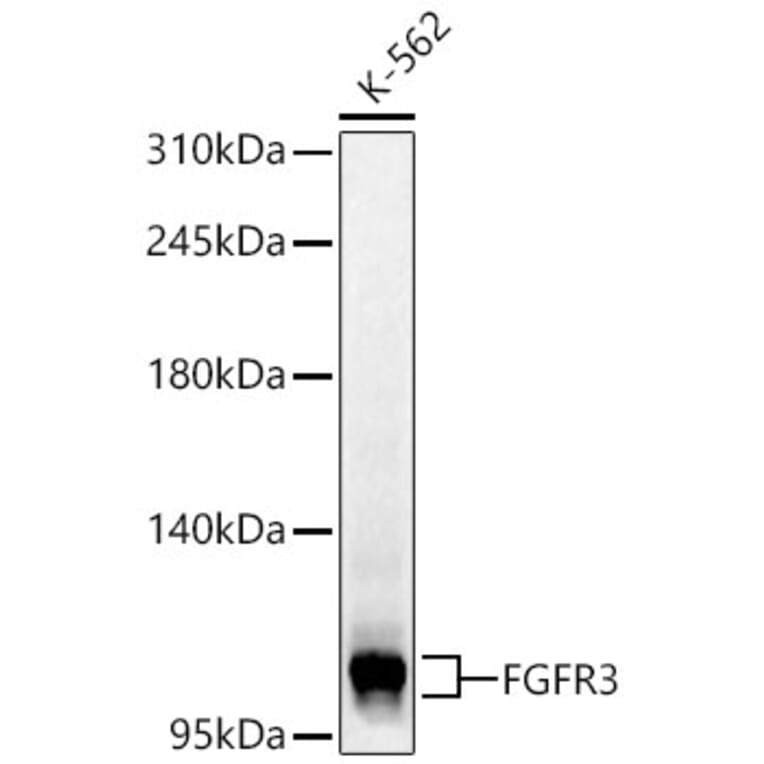 Western Blot - Anti-FGFR3 Antibody (A329371) - Antibodies.com