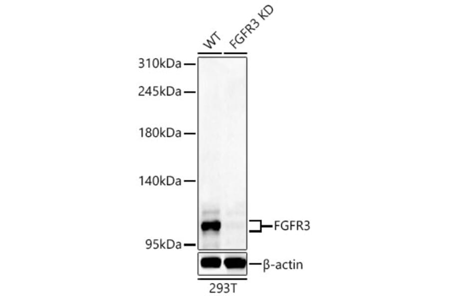 Western Blot - Anti-FGFR3 Antibody (A329371) - Antibodies.com