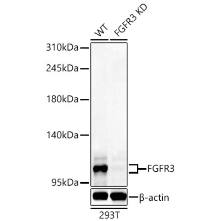 Western Blot - Anti-FGFR3 Antibody (A329371) - Antibodies.com