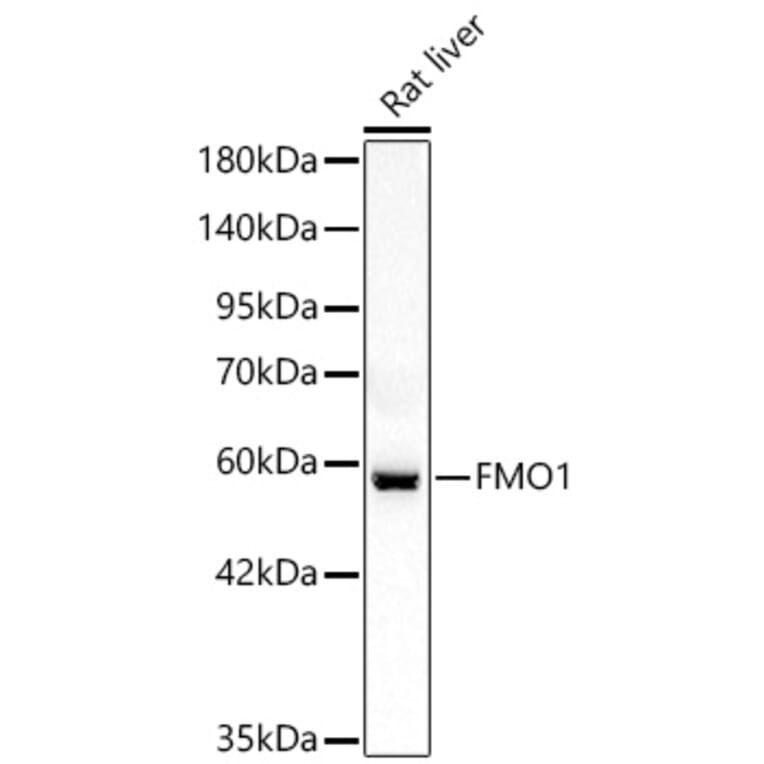 Western Blot - Anti-FMO1 Antibody (A329374) - Antibodies.com