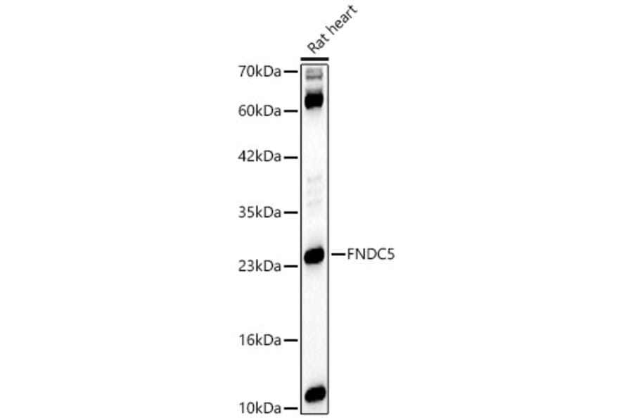 Western Blot - Anti-FNDC5 Antibody (A329375) - Antibodies.com