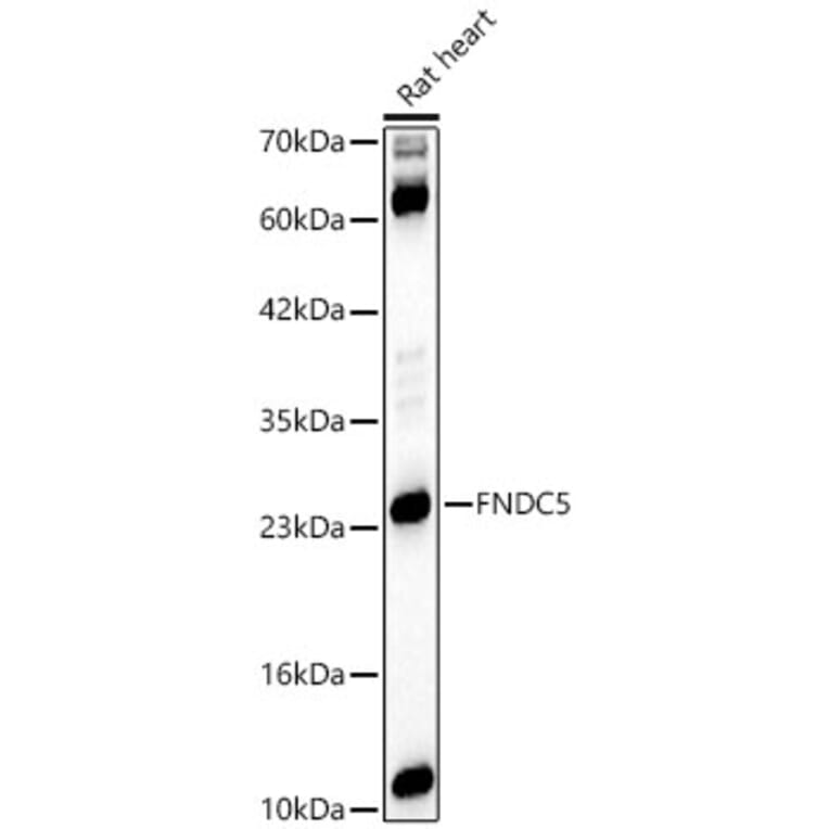 Western Blot - Anti-FNDC5 Antibody (A329375) - Antibodies.com