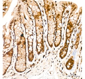 Immunohistochemistry - Anti-FRA2 Antibody (A329378) - Antibodies.com