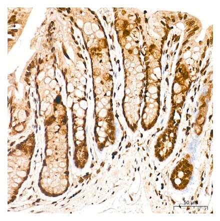 Immunohistochemistry - Anti-FRA2 Antibody (A329378) - Antibodies.com
