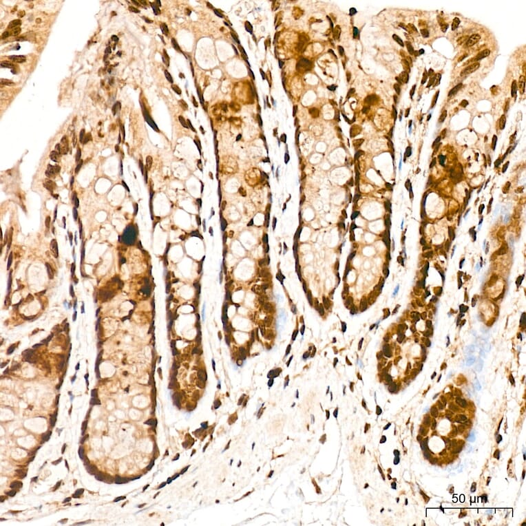 Immunohistochemistry - Anti-FRA2 Antibody (A329378) - Antibodies.com