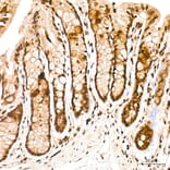 Immunohistochemistry - Anti-FRA2 Antibody (A329378) - Antibodies.com