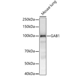 Western Blot - Anti-GAB1 Antibody [ARC52035] (A329382) - Antibodies.com