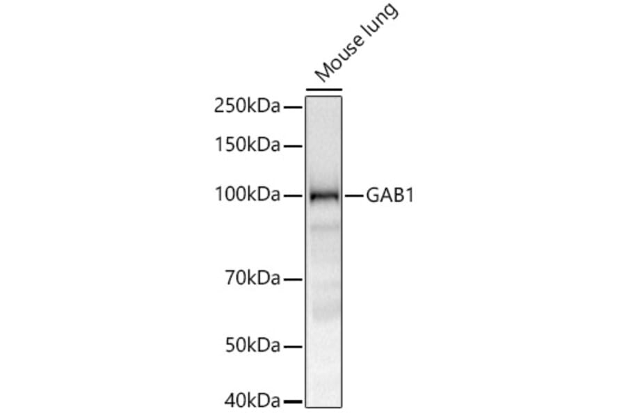 Western Blot - Anti-GAB1 Antibody [ARC52035] (A329382) - Antibodies.com
