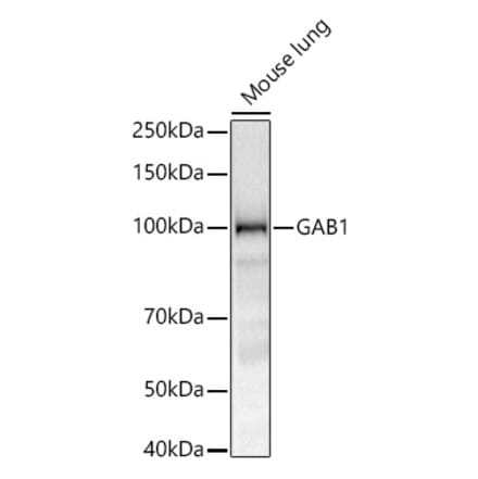 Western Blot - Anti-GAB1 Antibody [ARC52035] (A329382) - Antibodies.com
