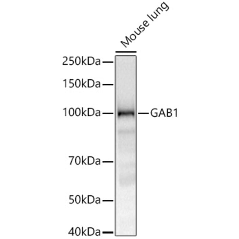 Western Blot - Anti-GAB1 Antibody [ARC52035] (A329382) - Antibodies.com