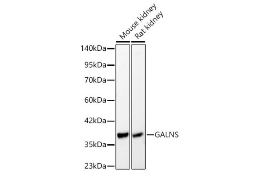 Western Blot - Anti-GALNS Antibody (A329386) - Antibodies.com