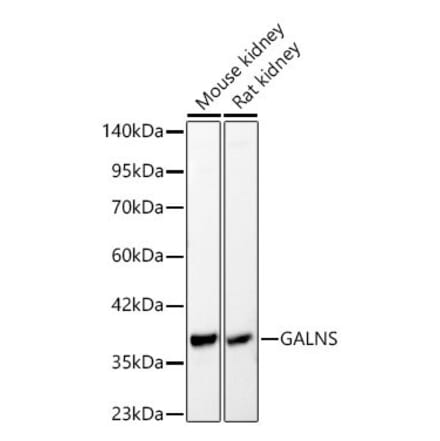 Western Blot - Anti-GALNS Antibody (A329386) - Antibodies.com