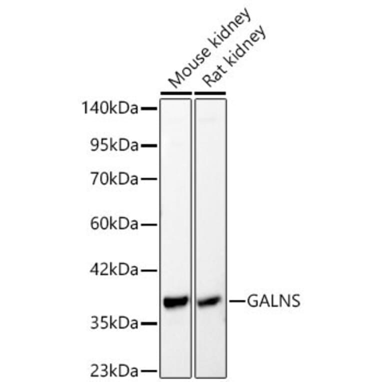 Western Blot - Anti-GALNS Antibody (A329386) - Antibodies.com