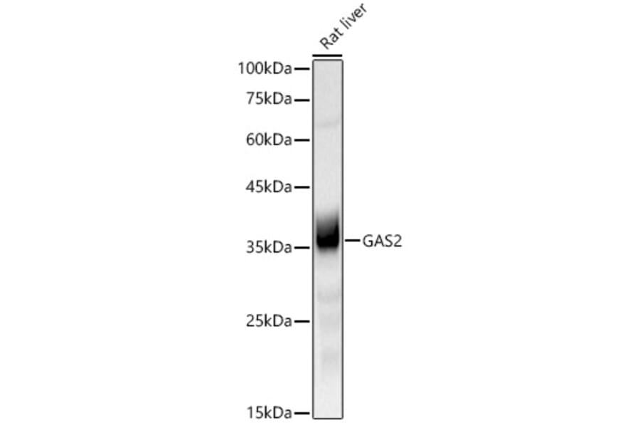 Western Blot - Anti-GAS2 Antibody [ARC3102] (A329387) - Antibodies.com