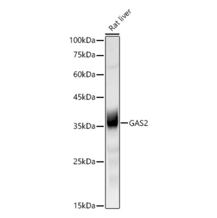 Western Blot - Anti-GAS2 Antibody [ARC3102] (A329387) - Antibodies.com