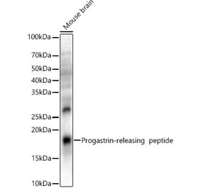 Western Blot - Anti-Gastrin Releasing Peptide Antibody (A329389) - Antibodies.com