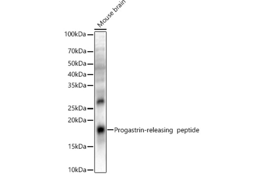 Western Blot - Anti-Gastrin Releasing Peptide Antibody (A329389) - Antibodies.com