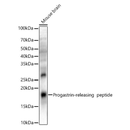 Western Blot - Anti-Gastrin Releasing Peptide Antibody (A329389) - Antibodies.com