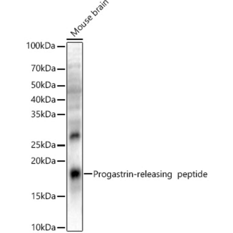 Western Blot - Anti-Gastrin Releasing Peptide Antibody (A329389) - Antibodies.com