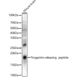 Western Blot - Anti-Gastrin Releasing Peptide Antibody (A329389) - Antibodies.com