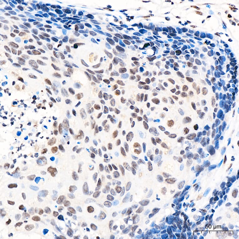 Immunohistochemistry - Anti-GATA2 Antibody (A329390) - Antibodies.com