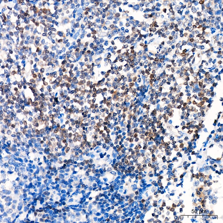 Immunohistochemistry - Anti-GATA2 Antibody (A329390) - Antibodies.com