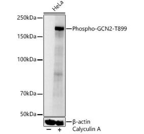 Western Blot - Anti-GCN2 (Phospho T899) Antibody (A329391) - Antibodies.com