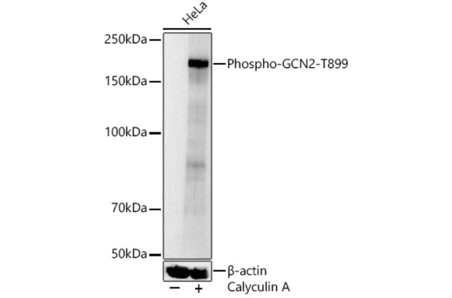 Western Blot - Anti-GCN2 (Phospho T899) Antibody (A329391) - Antibodies.com