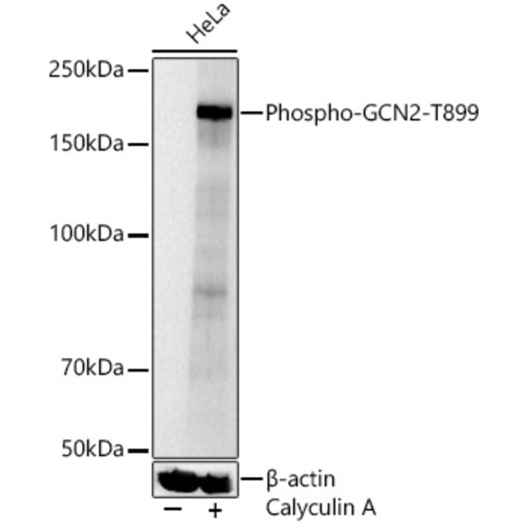 Western Blot - Anti-GCN2 (Phospho T899) Antibody (A329391) - Antibodies.com