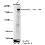 Western Blot - Anti-GCN2 (Phospho T899) Antibody (A329391) - Antibodies.com